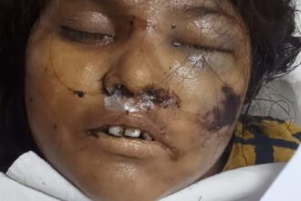 মৃত অজ্ঞাতনামা মহিলা এর আত্নীয় স্বজনদের সন্ধান চায় কোতোয়ালী মডেল থানা পুলিশ 20 মৃত অজ্ঞাতনামা মহিলা এর আত্নীয় স্বজনদের সন্ধান চায় কোতোয়ালী মডেল থানা পুলিশ - Surma Times | Sylhet News
