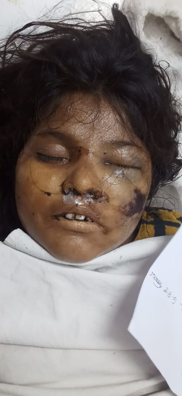 মৃত অজ্ঞাতনামা মহিলা এর আত্নীয় স্বজনদের সন্ধান চায় কোতোয়ালী মডেল থানা পুলিশ - Surma Times | Sylhet News