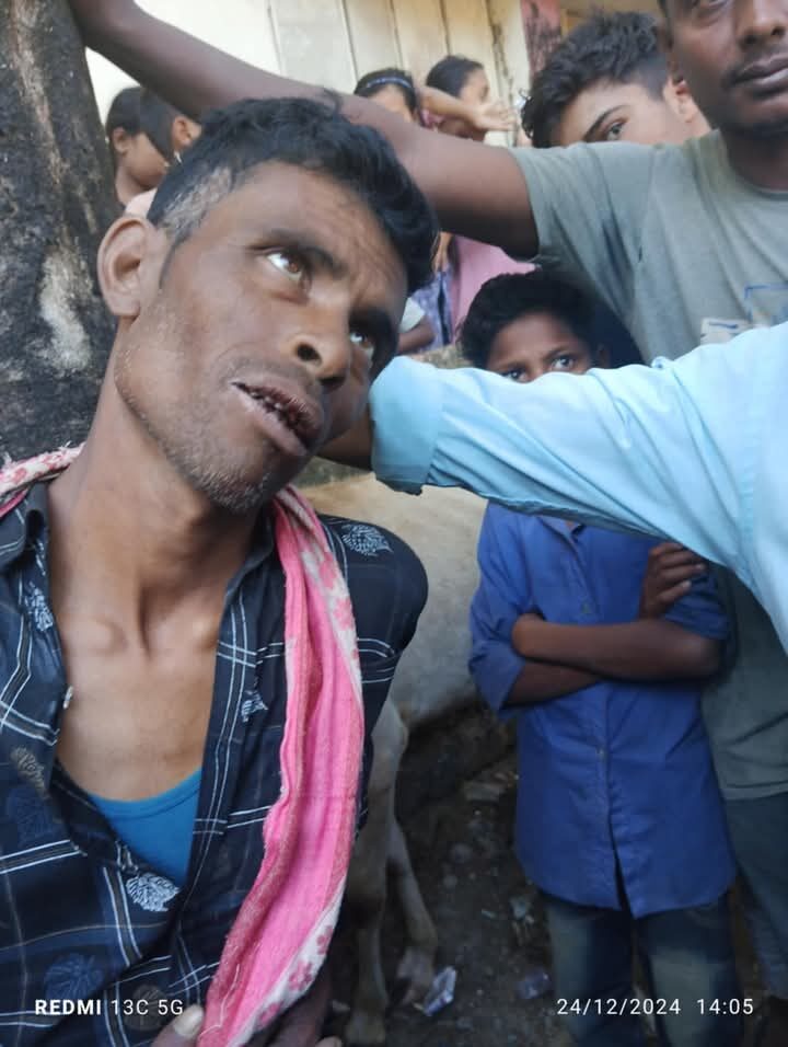 গোয়াইনঘাটে চোরির অভিযোগে গণপিটুনি নিহত ১ আহত ১ - Surma Times | Sylhet News