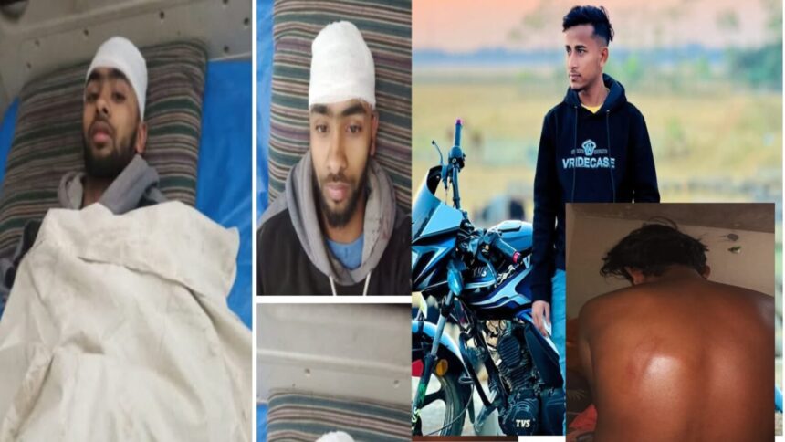 গোয়াইনঘাটে অনাকাঙ্ক্ষিত ভাবে পুলিশের লাঠি চার্জে দু’জন আহত: ওসির দুঃখ প্রকাশ - Surma Times | Sylhet News