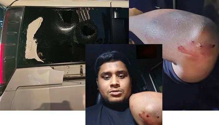 হাসনাত আব্দুল্লাহর উপর হামলা 1 হাসনাত আব্দুল্লাহর উপর হামলা - Surma Times | Sylhet News