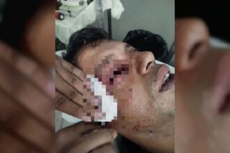 চলন্ত ট্রেনে পাথর ছোড়া, চোখ হারালেন আইনজীবী 16 চলন্ত ট্রেনে পাথর ছোড়া, চোখ হারালেন আইনজীবী - Surma Times | Sylhet News