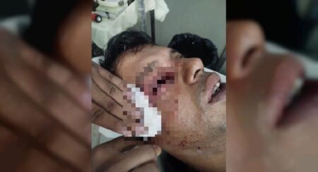 চলন্ত ট্রেনে পাথর ছোড়া, চোখ হারালেন আইনজীবী - Surma Times | Sylhet News
