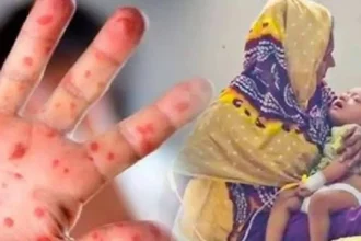 হামে আরও ৭ শিশুর মৃত্যু, মোট মৃত ৬৪৫ 26 হামে আরও ৭ শিশুর মৃত্যু, মোট মৃত ৬৪৫ - Surma Times | Sylhet News