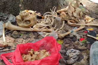 হবিগঞ্জ হাসপাতালে মানব কঙ্কাল: আতঙ্কের পর যা জানা গেল 8 হবিগঞ্জ হাসপাতালে মানব কঙ্কাল: আতঙ্কের পর যা জানা গেল - Surma Times | Sylhet News