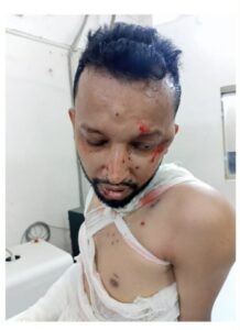 এটিএম তুরাবঃ শাহাদাতের ২ বছর, বেদনা-ব্যর্থতার উপাখ্যান - Surma Times | Sylhet News