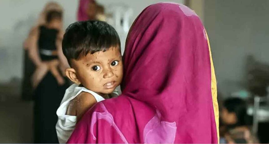 সিলেট সহ সারা দেশে হামের উপসর্গে ৫ শিশুর মৃত্যু 1 সিলেট সহ সারা দেশে হামের উপসর্গে ৫ শিশুর মৃত্যু - Surma Times | Sylhet News